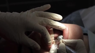 دندانپزشکی در پونک | دندانپزشکی پونک