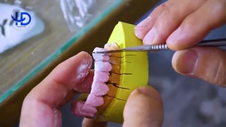 همه چیز درباره شغل و درآمد دندانسازی