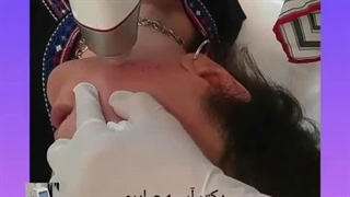دکتر قاسم رحمت پوررکنی متخصص پوست ساری دکتر پوست