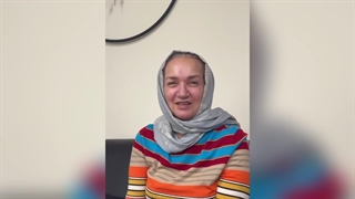 رضایت کلاینت لیفت با نخ و فیلر خط خنده در کلینیک رژوه