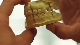 ارتودنسی و جراحی فک | دکتر داودیان