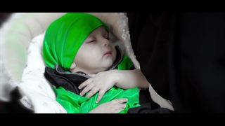 هم‌صحبت با علی اصغر (ع) مزوتراپی