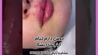 ژل نورامیس برای لب خوبه ؟