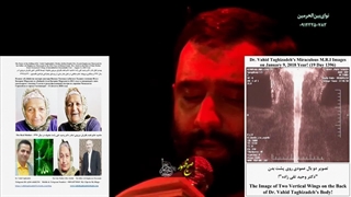 67B) کلیپ دکتر وحید تقی زاده درباره قتل مادرم (فضه باقریان) توسط علی باقریان در 1391 و بدلکاری سه زن بدلی: ذوقی، احتشام، خجسته