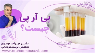 میدونی پی ار پی چیه و با این هزینه کم چه مزایایی داره