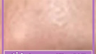بوکال فت و فرم دهی صورت با آن